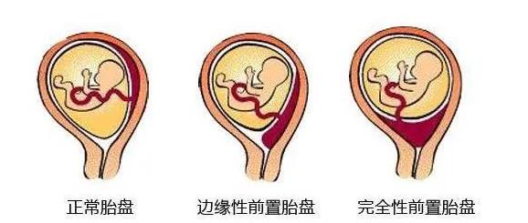 360截图20230810145330747.jpg